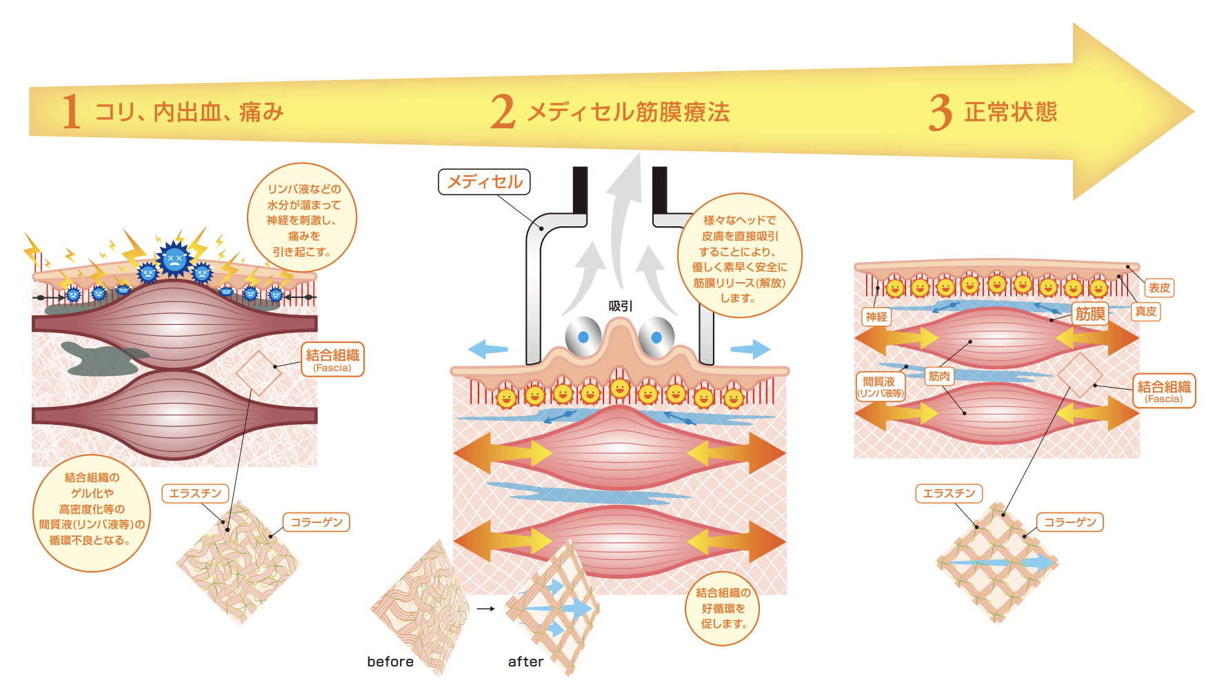 InBody測定の様子